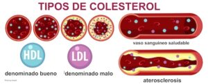 colesterol en la dieta keto